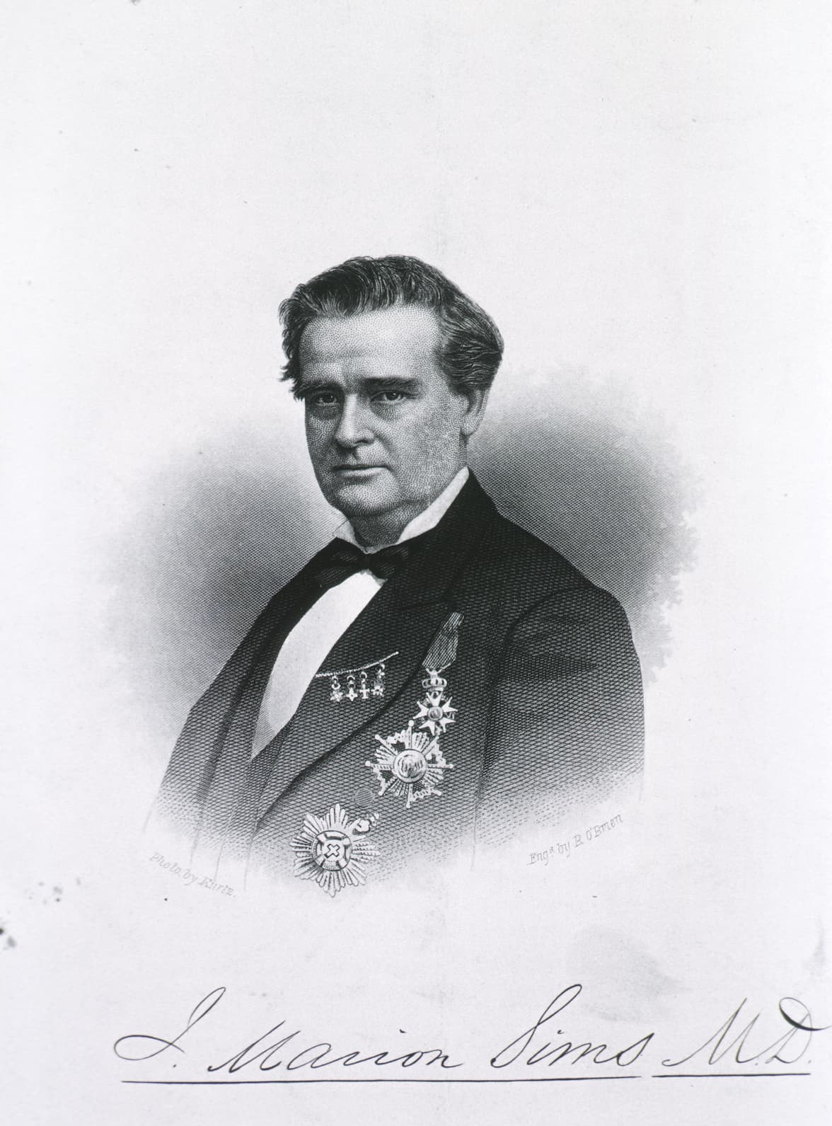 J. Marion Sims, a 19th century doctor lauded as a pioneer in gynecological medicine, conducted medical experiments on enslaved Black women. Photo Credit: National Library of Medicine.