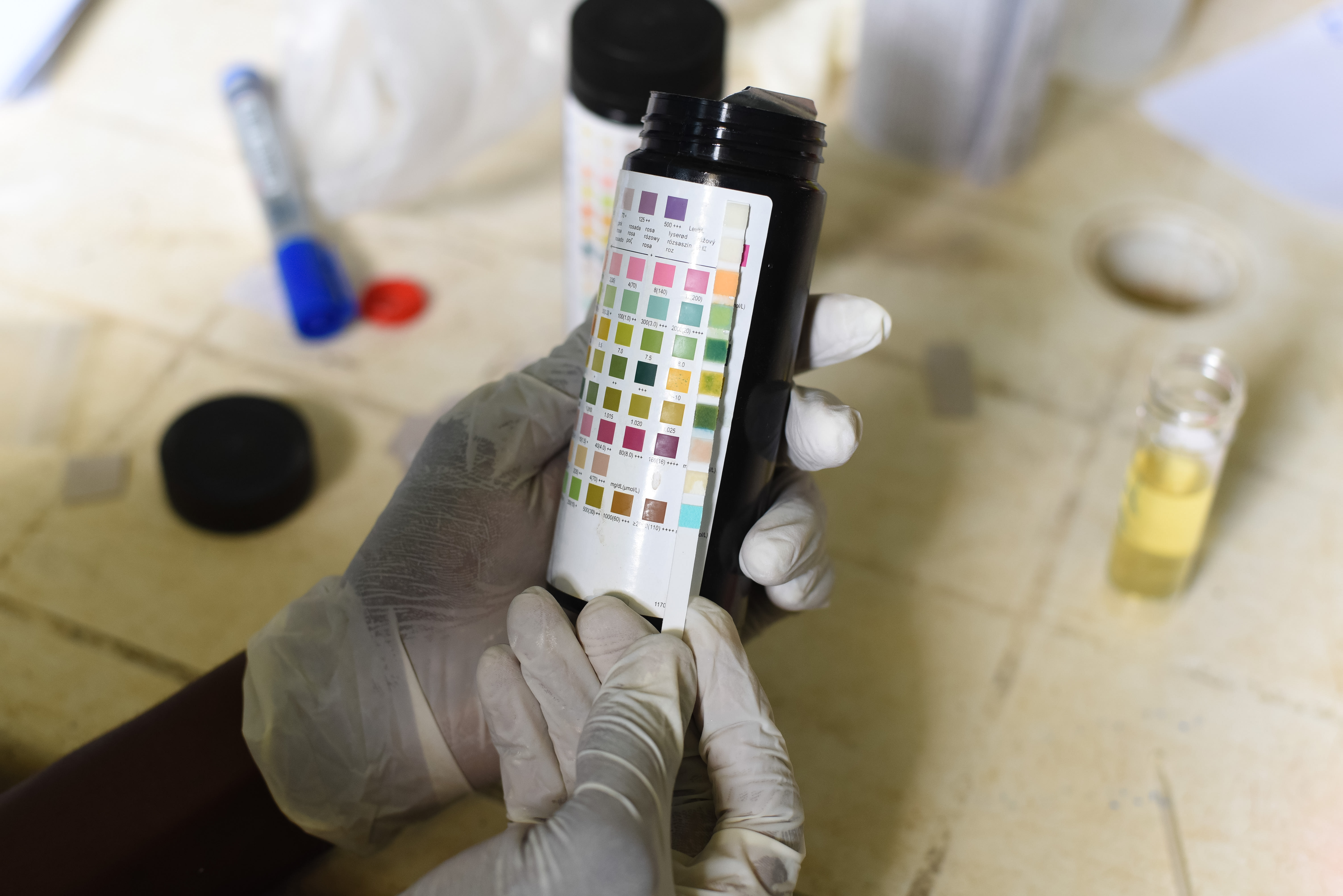 A health worker in Langbin uses a diagnostic strip to test a resident’s urine sample for signs of blood and infection. These rapid tests help establish a direct link between the community’s health issues and parasites present in the local river water. Photo credit: Bukunmi Oyewole, December 11, 2020.